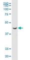 NPR2 Like, GATOR1 Complex Subunit antibody, H00010641-B01P, Novus Biologicals, Western Blot image 