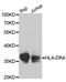Major Histocompatibility Complex, Class II, DR Alpha antibody, MBS127270, MyBioSource, Western Blot image 