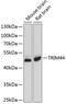 Tripartite Motif Containing 44 antibody, GTX65544, GeneTex, Western Blot image 