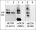 Eukaryotic Elongation Factor 2 Kinase antibody, EP5461, ECM Biosciences, Western Blot image 
