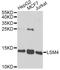 LSM4 Homolog, U6 Small Nuclear RNA And MRNA Degradation Associated antibody, A13588, ABclonal Technology, Western Blot image 