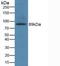 Glutamate Ionotropic Receptor NMDA Type Subunit 2B antibody, abx129150, Abbexa, Western Blot image 