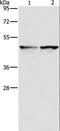 Isocitrate Dehydrogenase (NADP(+)) 1, Cytosolic antibody, LS-C404638, Lifespan Biosciences, Western Blot image 