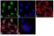 Keratin 5 antibody, MA5-12596, Invitrogen Antibodies, Immunofluorescence image 