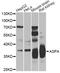 Aspartoacylase antibody, A7271, ABclonal Technology, Western Blot image 