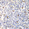 Proteasome 26S Subunit, Non-ATPase 7 antibody, 19-610, ProSci, Immunohistochemistry paraffin image 