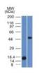 Perilipin 2 antibody, NBP2-53401, Novus Biologicals, Western Blot image 