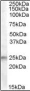 Insulin Like Growth Factor Binding Protein 6 antibody, orb89321, Biorbyt, Western Blot image 