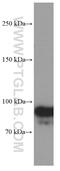 OTU Deubiquitinase 7B antibody, 66276-1-Ig, Proteintech Group, Western Blot image 