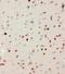Mitogen-Activated Protein Kinase Kinase Kinase 3 antibody, GTX12204, GeneTex, Immunohistochemistry paraffin image 