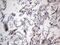 Immunoglobulin Superfamily Member 11 antibody, M09664, Boster Biological Technology, Immunohistochemistry paraffin image 