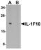 Interleukin 1 Family Member 10 antibody, LS-C201139, Lifespan Biosciences, Western Blot image 