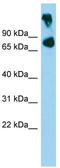 ATP Binding Cassette Subfamily B Member 8 antibody, TA332014, Origene, Western Blot image 