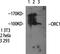 Origin Recognition Complex Subunit 1 antibody, A02735, Boster Biological Technology, Western Blot image 