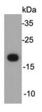 CLDN7 antibody, NBP2-66784, Novus Biologicals, Western Blot image 