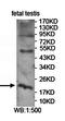 Asparaginase Like 1 antibody, orb78470, Biorbyt, Western Blot image 