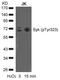 Spleen Associated Tyrosine Kinase antibody, PA5-37746, Invitrogen Antibodies, Western Blot image 