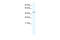 Insulin gene enhancer protein ISL-2 antibody, 28-660, ProSci, Western Blot image 