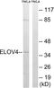 ELOVL Fatty Acid Elongase 4 antibody, abx014455, Abbexa, Western Blot image 