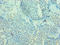 MHC Class I Polypeptide-Related Sequence A antibody, LS-C376127, Lifespan Biosciences, Immunohistochemistry paraffin image 