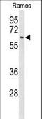Eukaryotic Translation Initiation Factor 2A antibody, LS-C167676, Lifespan Biosciences, Western Blot image 