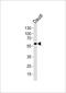 Cholinergic Receptor Nicotinic Alpha 9 Subunit antibody, PA5-49341, Invitrogen Antibodies, Western Blot image 
