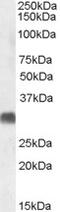 Unc-5 Netrin Receptor C antibody, 42-092, ProSci, Enzyme Linked Immunosorbent Assay image 