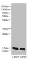 Putative uncharacterized protein C10orf40 antibody, A62162-100, Epigentek, Western Blot image 