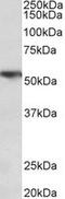 TNF Receptor Superfamily Member 1A antibody, MBS422751, MyBioSource, Western Blot image 