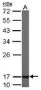 ATP Synthase F1 Subunit Delta antibody, TA308850, Origene, Western Blot image 