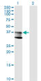 Sphingomyelin Phosphodiesterase 1 antibody, LS-C198226, Lifespan Biosciences, Western Blot image 