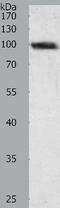 Glycogen Phosphorylase B antibody, TA322942, Origene, Western Blot image 