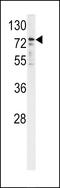 Cytochrome P450 Oxidoreductase antibody, 62-295, ProSci, Western Blot image 