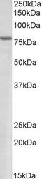 SET Domain Bifurcated Histone Lysine Methyltransferase 2 antibody, STJ70279, St John