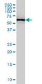 Phenylalanyl-TRNA Synthetase Subunit Beta antibody, H00010056-M01, Novus Biologicals, Western Blot image 
