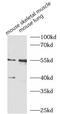 Myocyte Enhancer Factor 2A antibody, FNab05100, FineTest, Western Blot image 