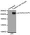 Acetyl-CoA Carboxylase Alpha antibody, STJ22006, St John