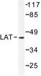 Linker For Activation Of T Cells antibody, AP06532PU-N, Origene, Western Blot image 