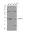 Ataxin 3 antibody, NBP1-32083, Novus Biologicals, Western Blot image 