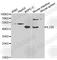 Interleukin-23 receptor antibody, A1613, ABclonal Technology, Western Blot image 