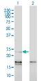 Endothelin 1 antibody, H00001906-M01, Novus Biologicals, Western Blot image 