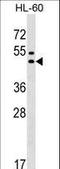 G Protein-Coupled Receptor 20 antibody, LS-C159768, Lifespan Biosciences, Western Blot image 