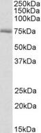 Peroxisomal carnitine O-octanoyltransferase antibody, TA311543, Origene, Western Blot image 