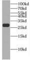 Eukaryotic Translation Initiation Factor 4E Family Member 2 antibody, FNab02721, FineTest, Western Blot image 