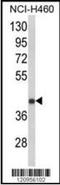 Ferrochelatase antibody, orb197933, Biorbyt, Western Blot image 