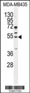 Cyclin B1 antibody, 55-622, ProSci, Western Blot image 