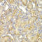 Protein Phosphatase 2 Regulatory Subunit Balpha antibody, LS-C335210, Lifespan Biosciences, Immunohistochemistry frozen image 