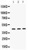 Orosomucoid 1 antibody, PB9956, Boster Biological Technology, Western Blot image 