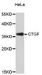 Cellular Communication Network Factor 2 antibody, abx125728, Abbexa, Western Blot image 