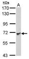 Leucine Rich Repeat Containing 1 antibody, GTX120541, GeneTex, Western Blot image 